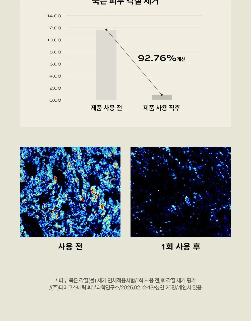 [화잘먹/손목세안밴드 증정] 휩드 머그트리 비건 쿠키 클레이 팩클렌저 180ml (단품/기획) 상세페이지 15